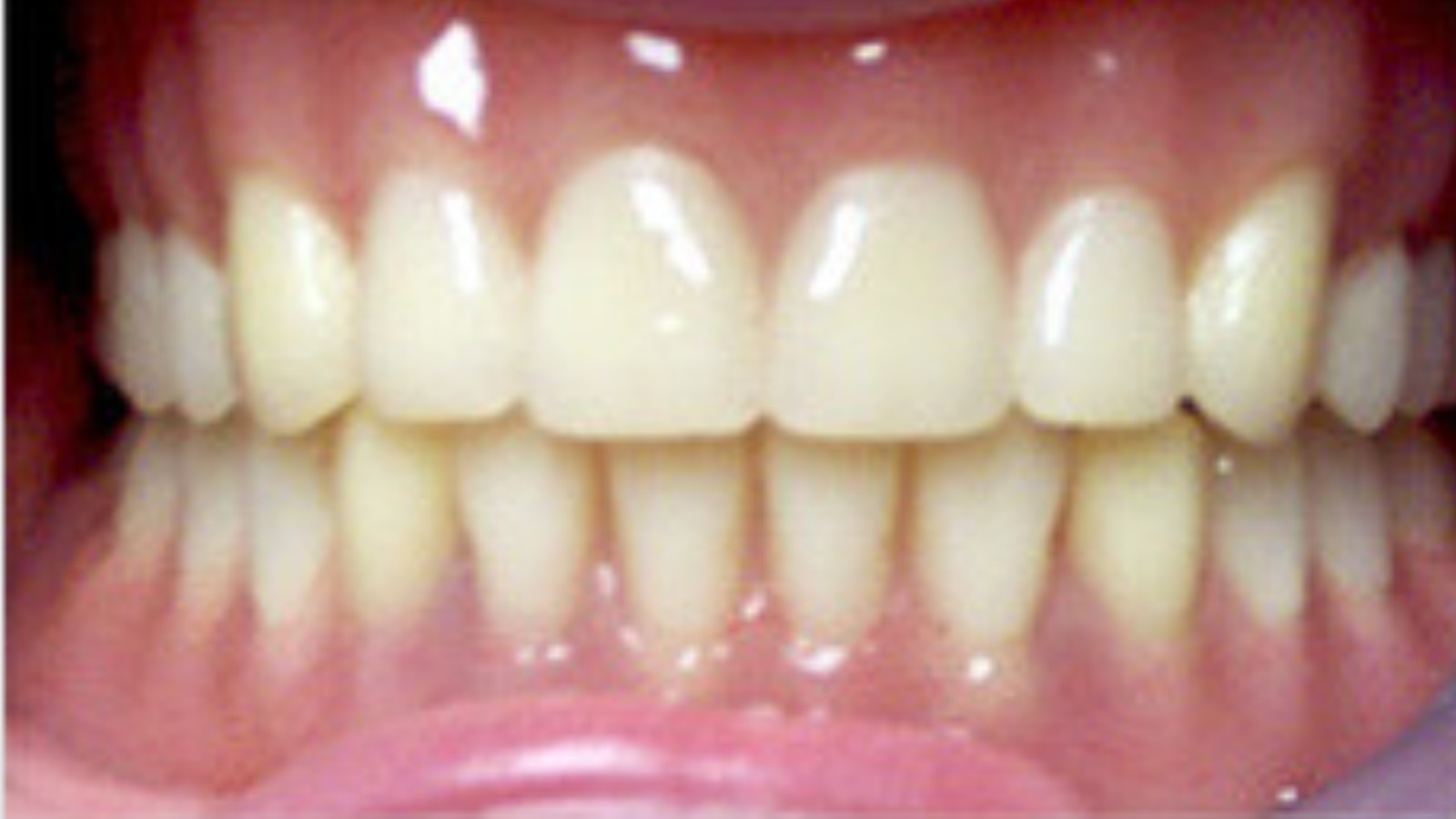 Teeth - North Barrie Dental