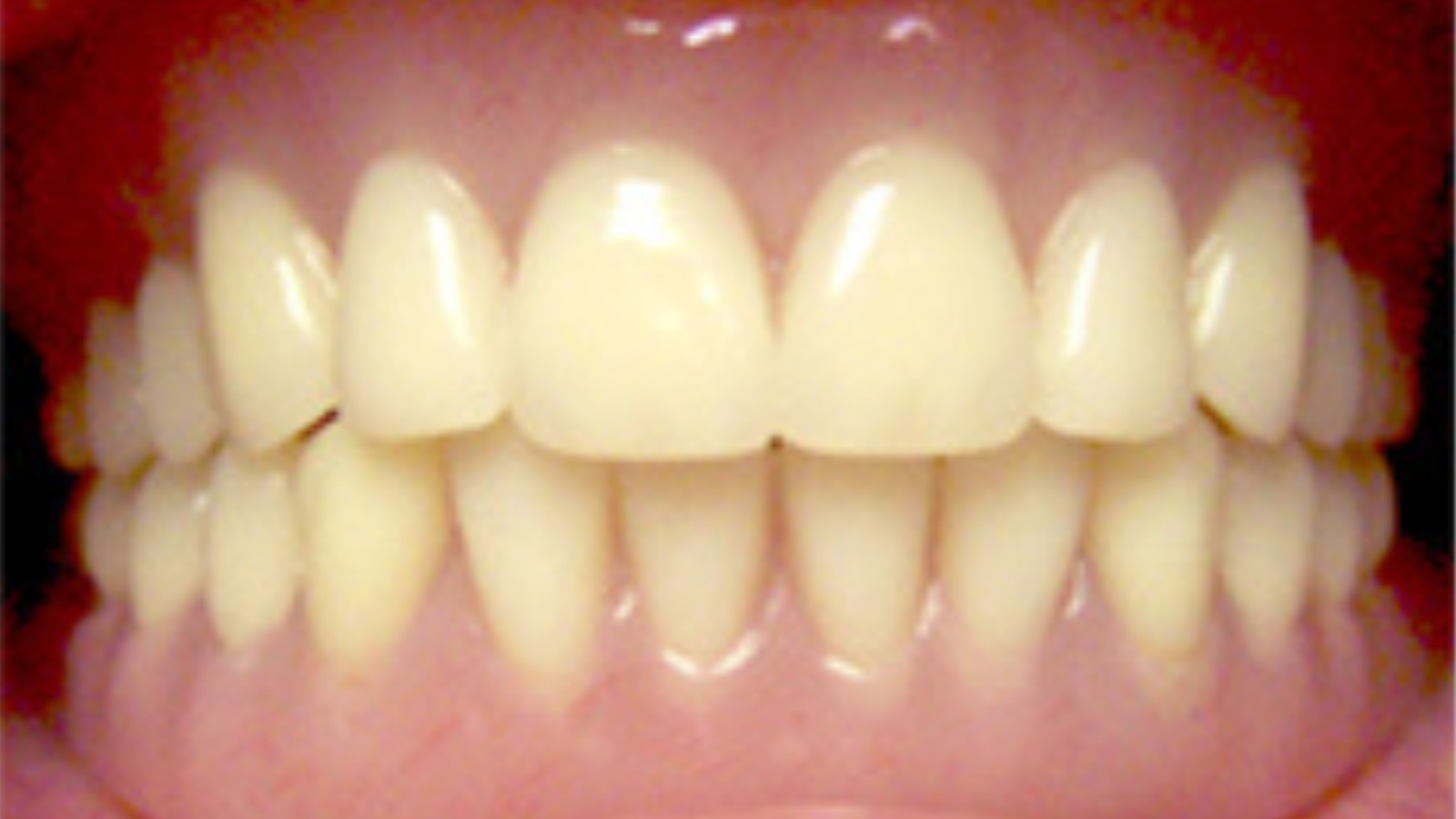 Teeth - North Barrie Dental