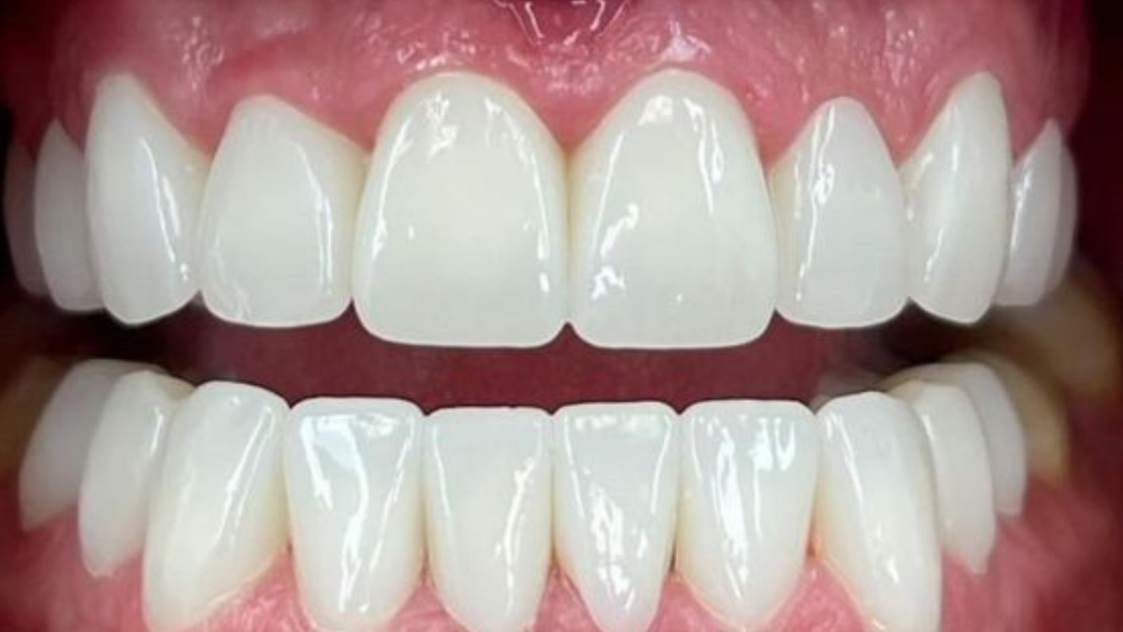 Teeth - North Barrie Dental