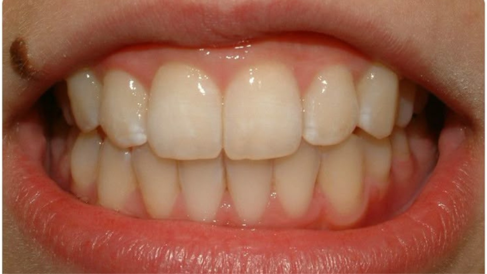 Teeth - North Barrie Dental