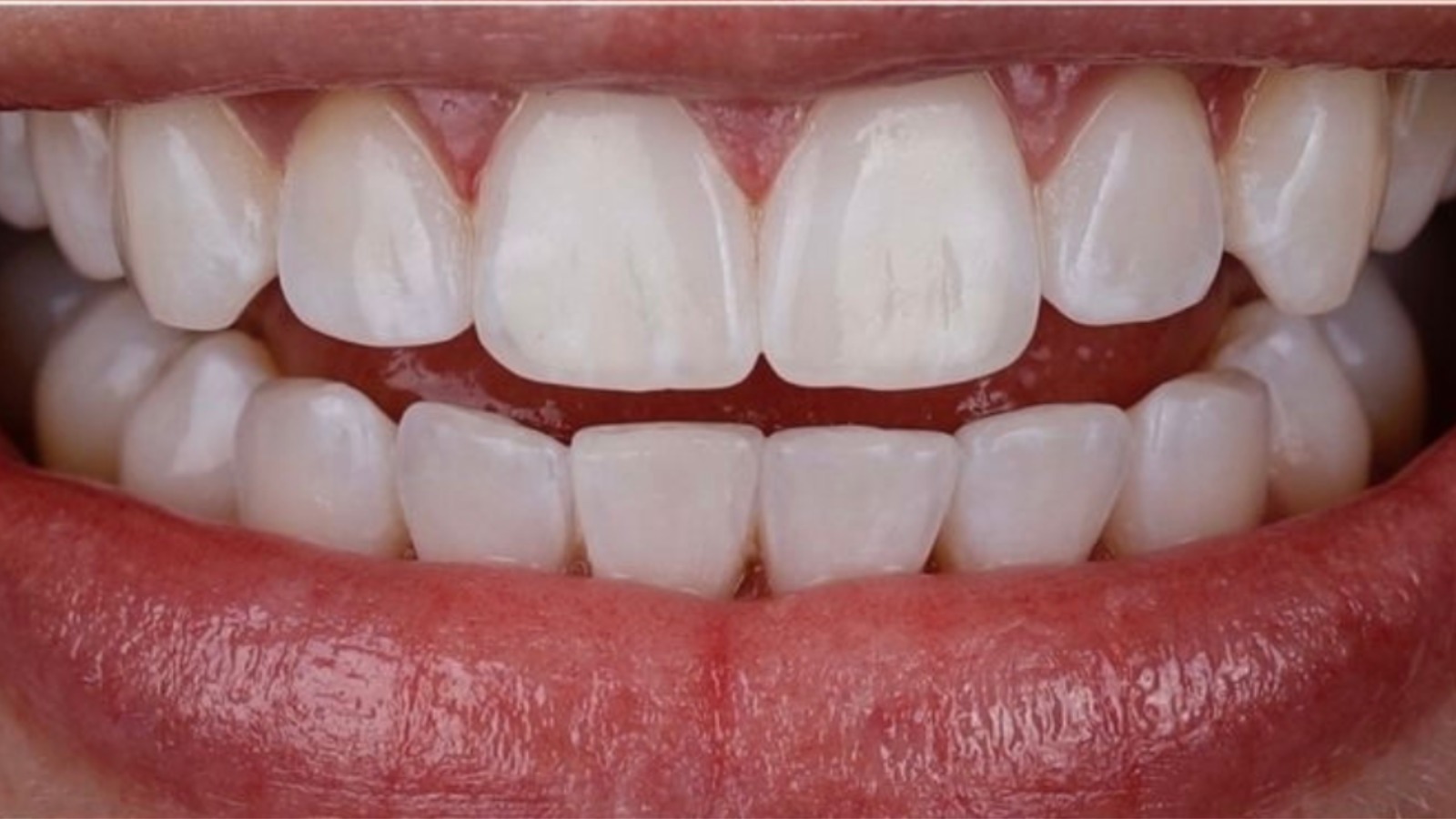 Teeth - North Barrie Dental