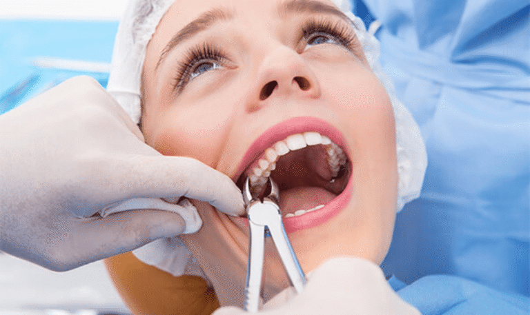 Tooth Extraction – North Barrie Dental