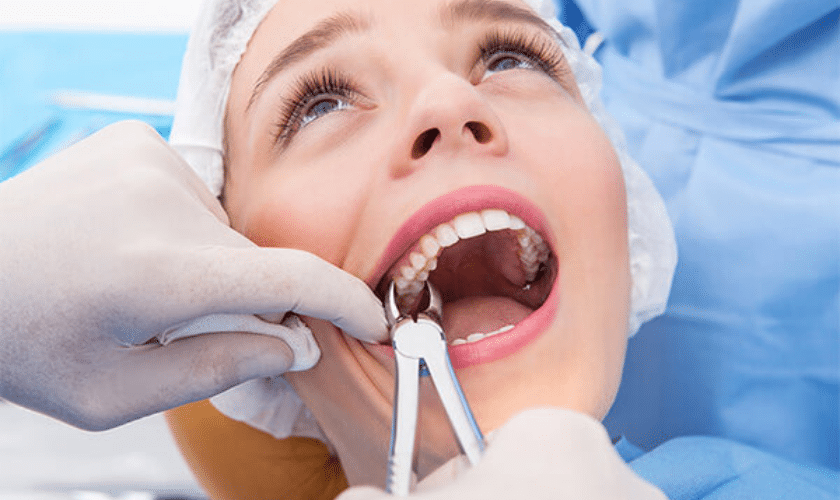 Tooth Extraction – North Barrie Dental